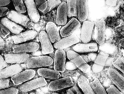 �����Կ��ף�vesicular stomatitis������
