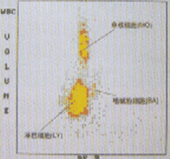 體積和電導,但只顯示嗜堿性粒細胞群