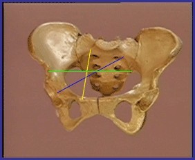 子宮韌帶:共有4對