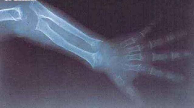 ����ܛ�ǰl����ȫ