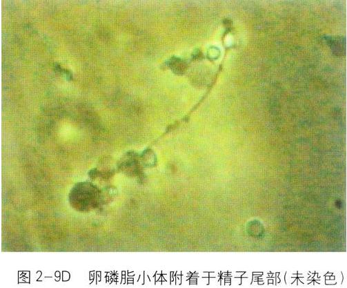 ��Һ�D�V�������w��β��֧ԭ�w��Ⱦ