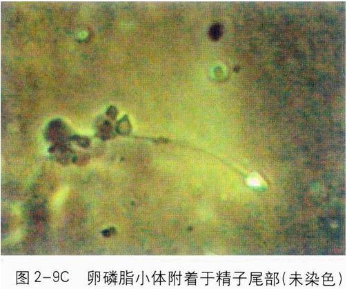 ��Һ�D�V�������w��β��֧ԭ�w��Ⱦ