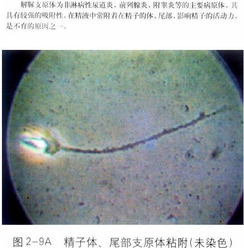 ��Һ�D�V�������w��β��֧ԭ�w��Ⱦ