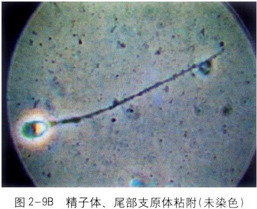 ��Һ�D�V�������w��β��֧ԭ�w��Ⱦ