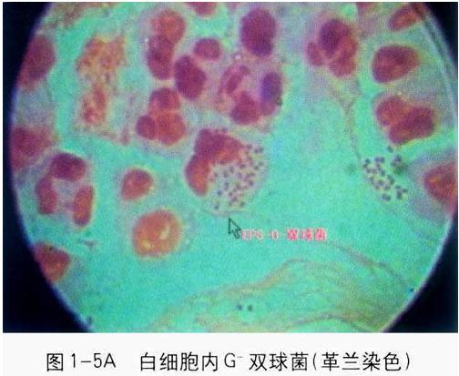 ǰ����Һ�D�V&mdash;&mdash;�׼�(x��)����(n��i)������m������p���