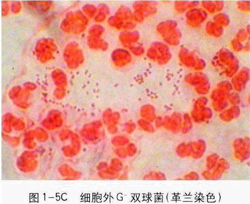 ǰ����Һ�D�V&mdash;&mdash;�׼�(x��)����(n��i)������m������p���