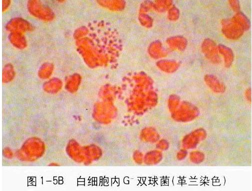 ǰ����Һ�D�V&mdash;&mdash;�׼�(x��)����(n��i)������m������p���